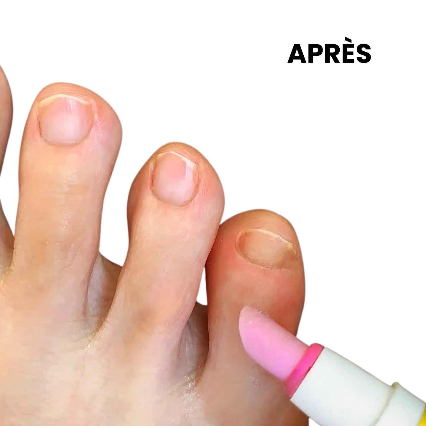 SassyTip – Stylo soin des cuticules