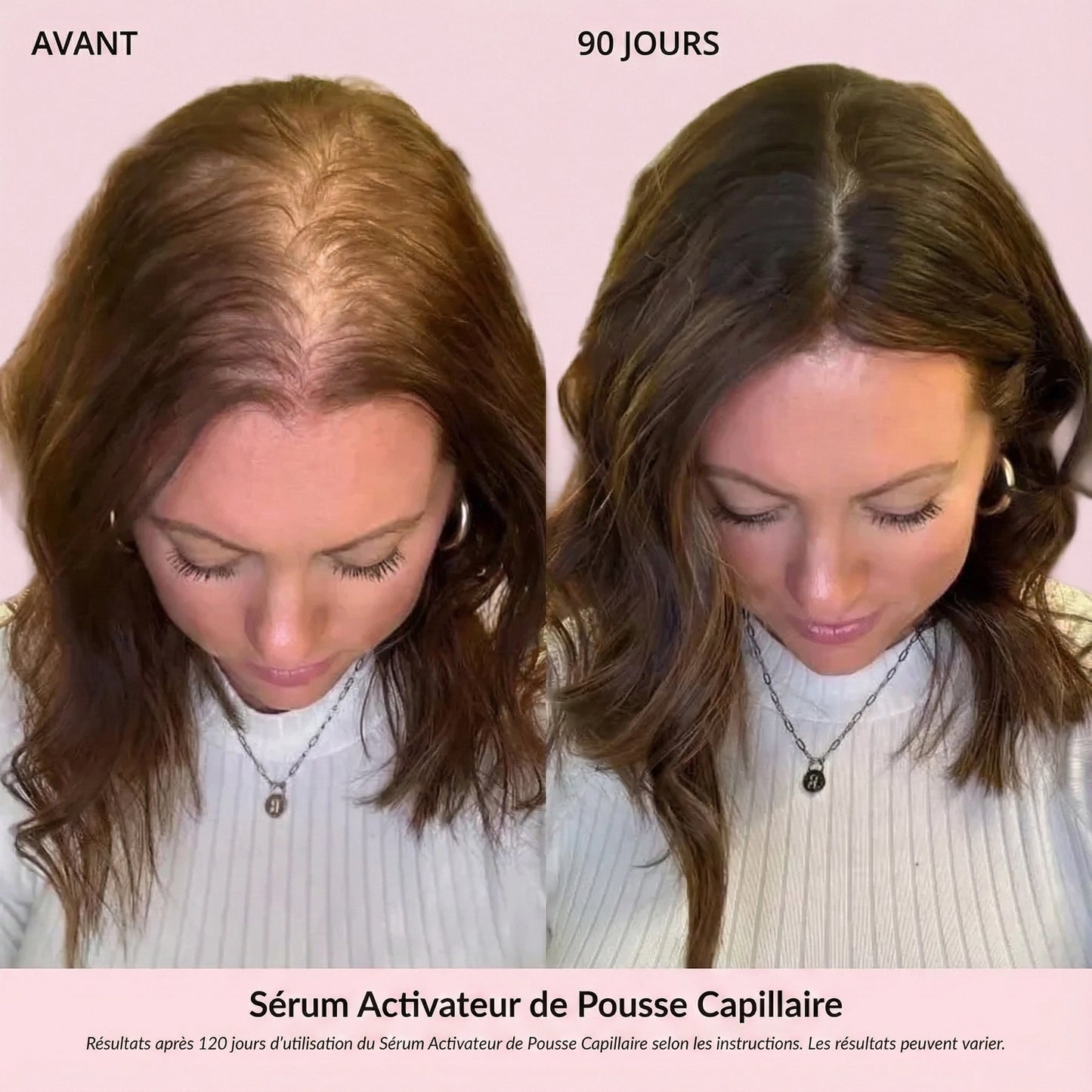 Sérum Activateur de Pousse Capillaire (Format Spray)