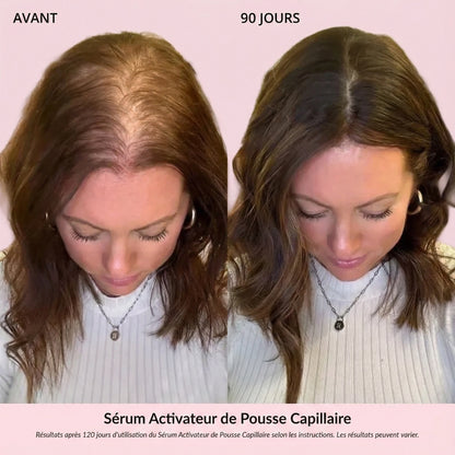Sérum Activateur de Pousse Capillaire (Format Spray)