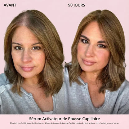Sérum Activateur de Pousse Capillaire (Format Spray)