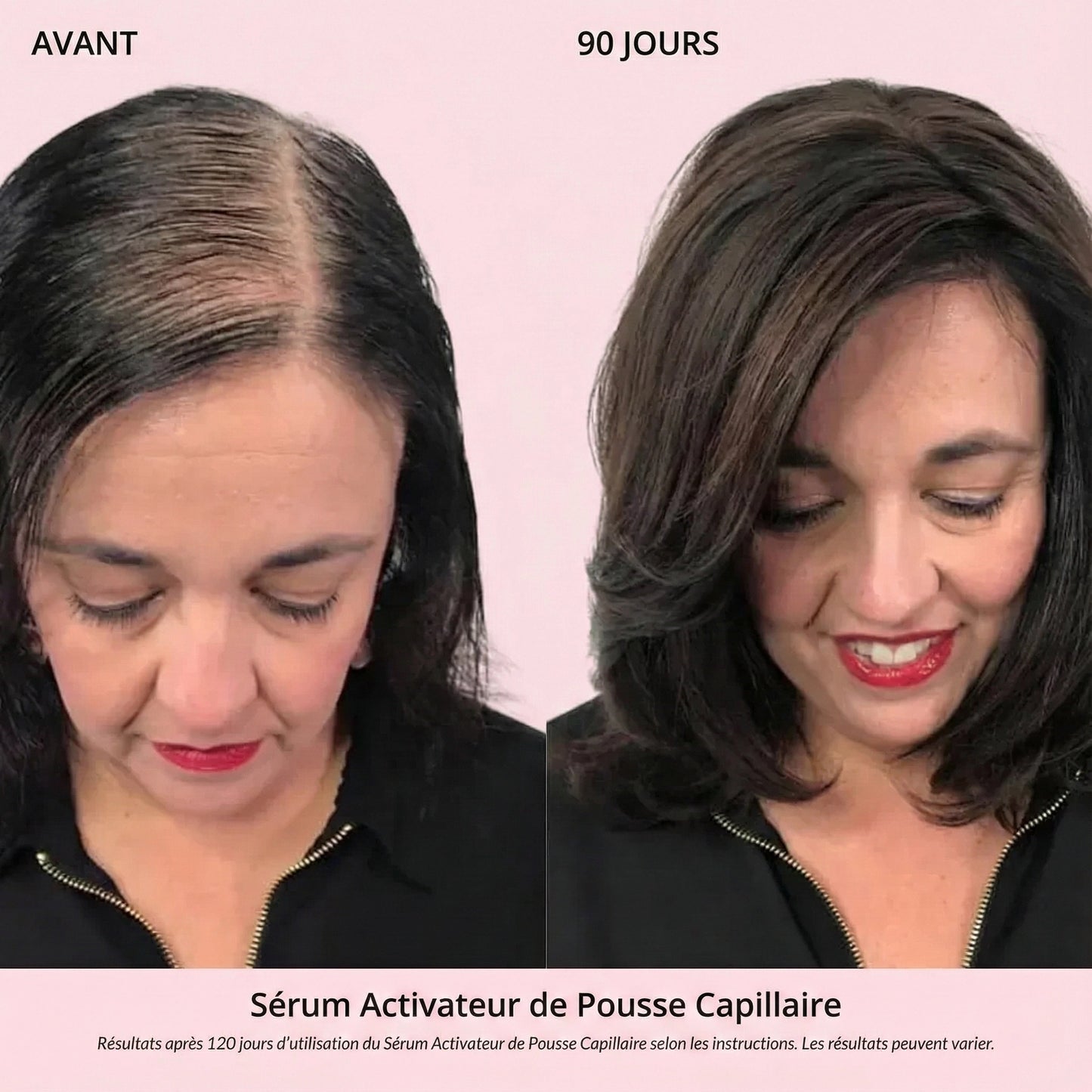 Sérum Activateur de Pousse Capillaire (Format Spray)