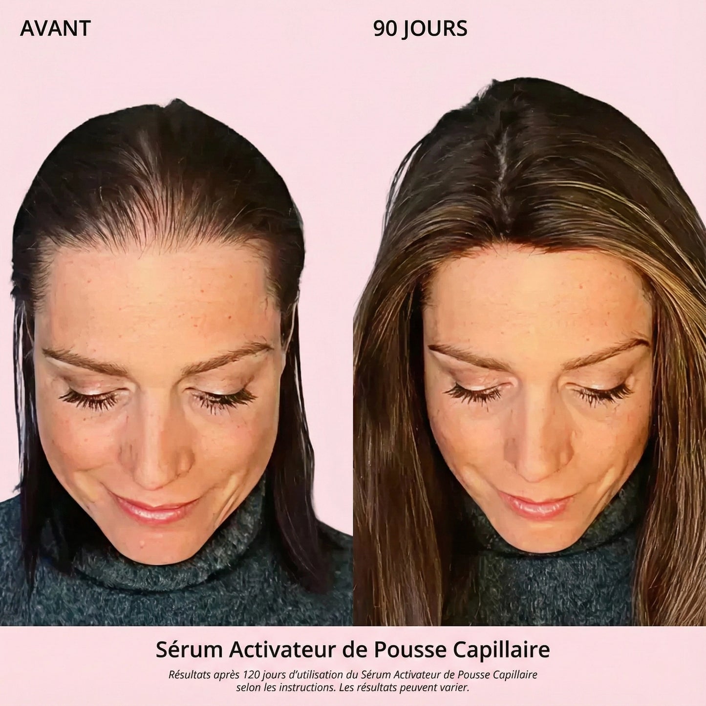Sérum Activateur de Pousse Capillaire (Format Spray)