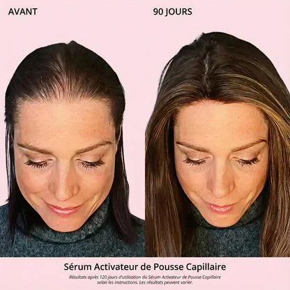 Sérum Activateur de Pousse Capillaire (Format Spray)