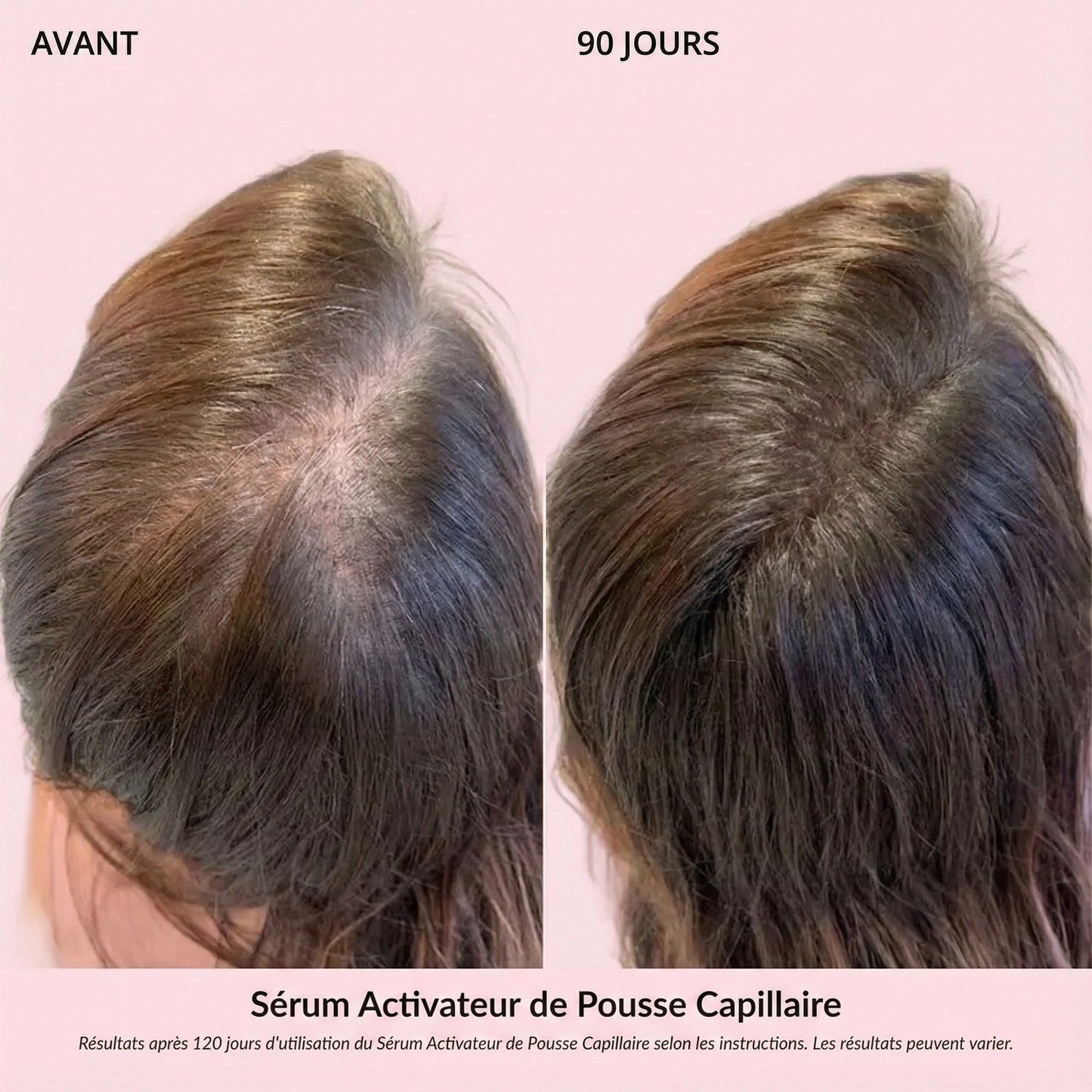 Sérum Activateur de Pousse Capillaire (Format Spray)