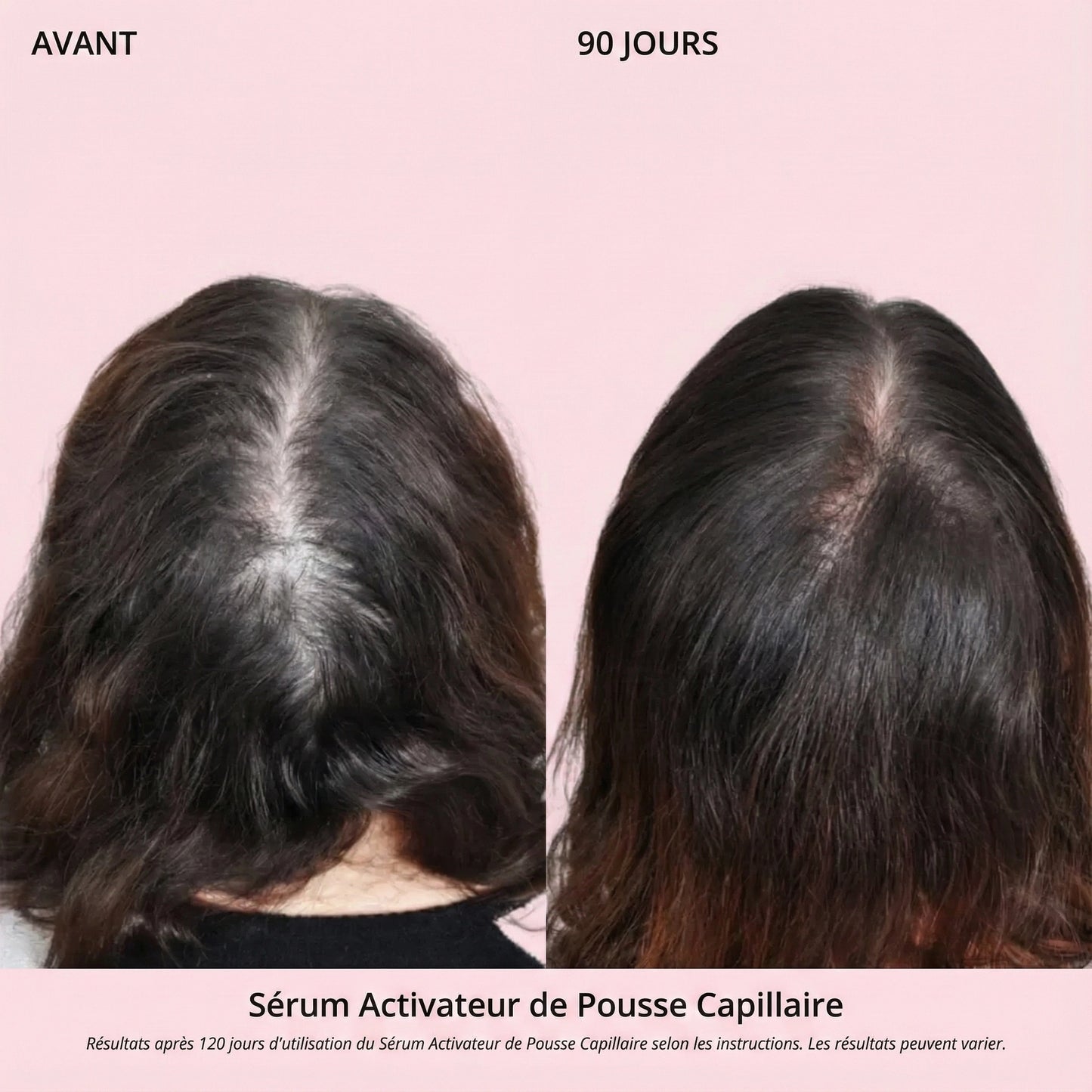 Sérum Activateur de Pousse Capillaire (Format Spray)