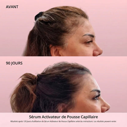 Sérum Activateur de Pousse Capillaire (Format Spray)