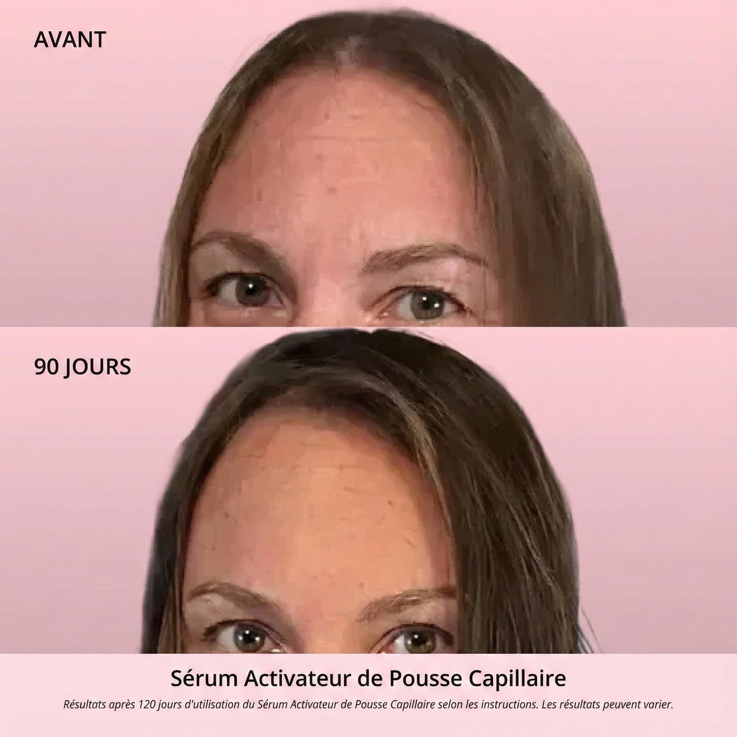 Sérum Activateur de Pousse Capillaire (Format Spray)