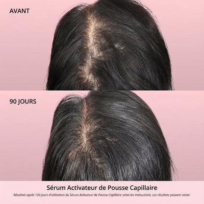 Sérum Activateur de Pousse Capillaire (Format Spray)
